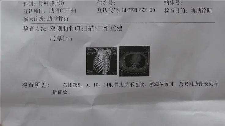 摔斷四根肋骨！那一刻，他得多疼啊……